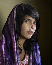 World Press Photo 2011 - nagrodzone prace