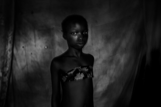 © Heba Khamis, Banned Beauty - I miejsce w kategorii CONTEMPORARY ISSUES STORIES / Praktyka „maskowania piersi“ u dziewcząt w wieku od ośmiu do dwunastu lat w Kamerunie odbywa się w przekonaniu, że opóźni to dojrzałość i pomoże zapobiec gwałtom lub wykorzystywaniu na tle seksualnym.