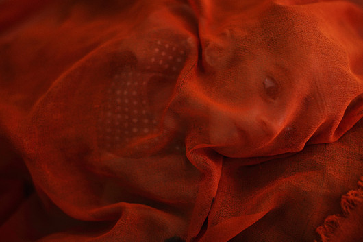 1. miejsce w kategorii Feature, fot. Andreas Quilty, Acute Malnutrition Crisis - Afghanistan