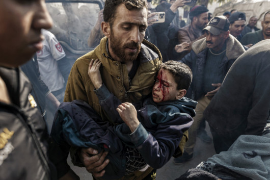 Fot. Saher Alghorra, The New York Time, Pulitzer Prize in Breaking News Phoography 2026Dziecko ranne w mieście Gaza w kwietniu, przewożone do szpitala. Izraelski samolot rozpoznawczy zaatakował dzielnicę Al-Thalathini w mieście Gaza, zabijając jednego Palestyńczyka i raniąc kilka kolejnych osób, w większości dzieci. (12.04.2025)