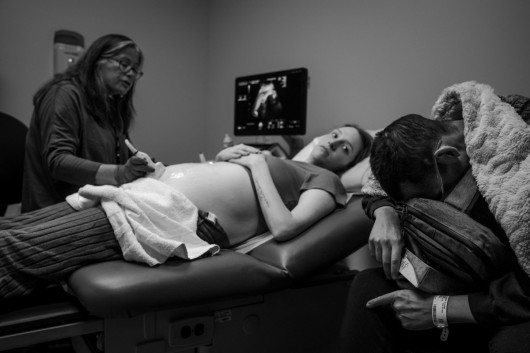Fot. Jahi Chikwendiu, The Washington Post, Pulitzer Prize in Feature Photography 2026PROVO, Utah - 15 kwietnia: Podczas prenatalnej wizyty kontrolnej dr Donna Dizon ogląda obrazy USG dziecka 28-letniej Shay Martin i 30-letniego Tannera Martina, który jest pod wpływem koktajlu leków przeciwnowotworowych, w placówce Intermountain - Utah Valley Maternal Fetal Medicine w Provo w stanie Utah.