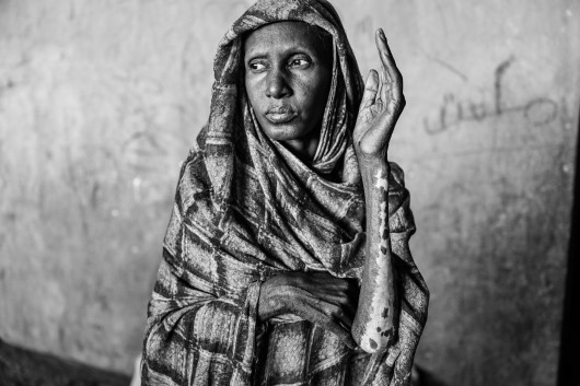 

fot. Abdulmonam Eassa / Le Monde, Sudan’s War: A Nation Trapped / Zwycięzca w kategorii Reportaż, region Afryka / World Press Photo 2026




Po rewolucji z 2019 roku, która obaliła trwającą od dekad dyktaturę, nadzieje Sudanu na demokrację zostały przekreślone przez wojskowy zamach stanu w 2021 roku. Dwa lata później armia i siły paramilitarne zwróciły się przeciwko sobie, rozpoczynając wojnę, która przerodziła się w jeden z najpoważniejszych kryzysów humanitarnych na świecie. W miarę jak głód się nasila, a podstawowe usługi przestają działać, zagraniczne mocarstwa wciąż podsycają konflikt, dostarczając broń. Ponad 13 milionów ludzi zostało zmuszonych do opuszczenia swoich domów, a co najmniej 150 tysięcy straciło życie. ONZ podaje, że w 2025 roku liczba zabójstw cywilów była ponad dwukrotnie wyższa niż rok wcześniej.