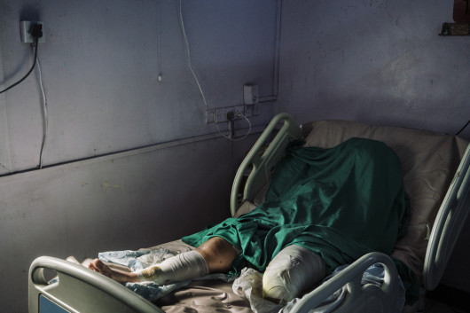 fot. Lorenzo Tugnoli, Contrasto (dla Washington Post), z cyklu the Yemen Crisis, Nominacja do nagrody World Press Photo Story of the Year

Po niemal 4 latach konfliktu w Jemenie, przynajmniej 8,4 mln osób zagrożonych jest głodem, a 22 miliony (75% populacji) wymaga pomocy humanitarnej.  
W 2014 roku muzułmańscy rebelianci Houthi Shia oblężyły północ kraju, zmuszając prezydenta Abdrabbuha Mansoura Hadiego do ustąpienia ze stanowiska. Konflikt rozprzestrzenił się gdy Arabia Saudyjska w koalicji z innymi państwami sunnickimi rozpoczęła naloty na pozycje Houthi. Do 2018 roku doprowadziło to jednej największych katastrof humanitarnych naszych czasów. 